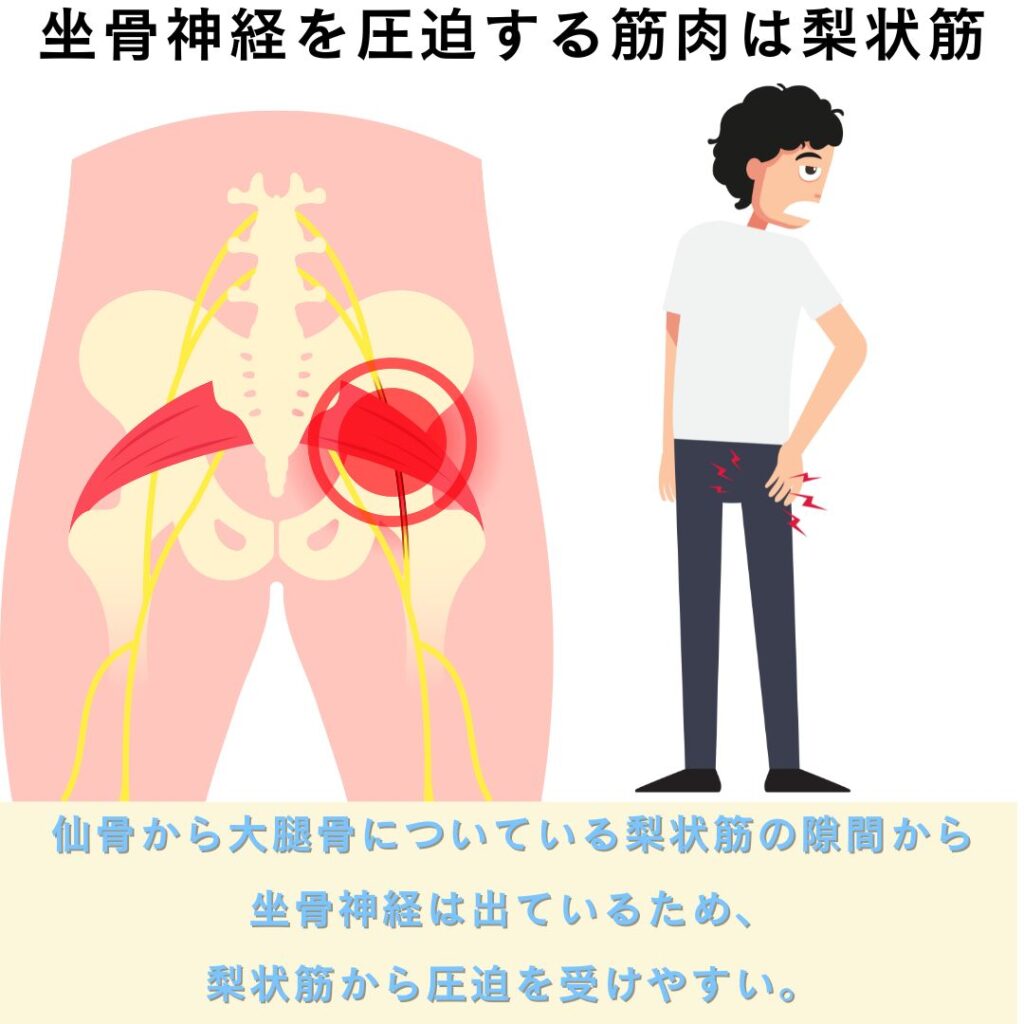 梨 状 筋
