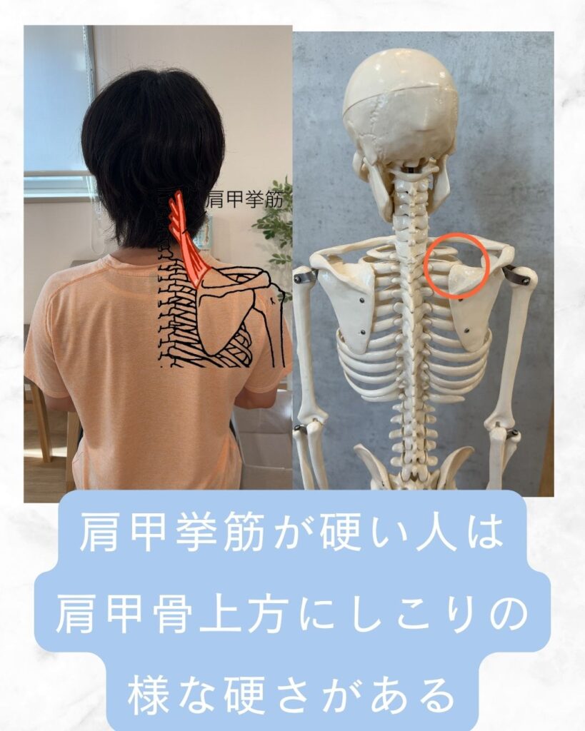 肩 甲 挙 筋 起 始 停止